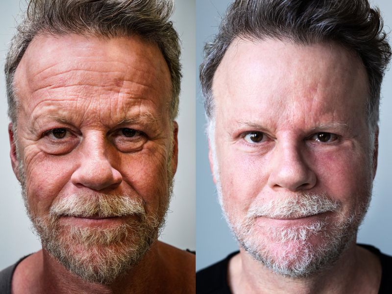 Mit seinem "Schönheits-Experiment" machte Jenke von Wilmsdorff Schlagzeilen wie mit keinem anderen Selbstversuch.