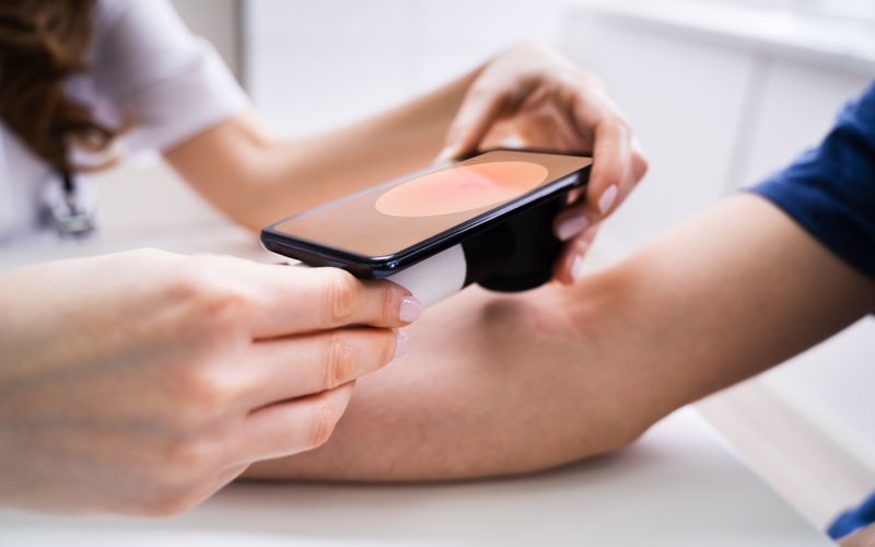 Auch Hautärzte nutzen Smartphones, um Hautkrankheiten zu diagnostizieren. Nun sollen sich Patienten bereits zu Hause  selbst untersuchen können.