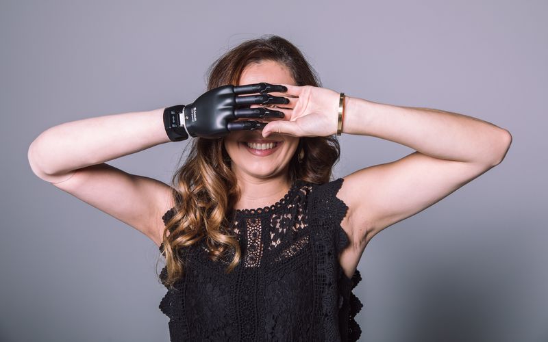 Jeder ist schön. Das Model Natalie Nußbaum hat eine Armprothese und wird von großen Marken gebucht.