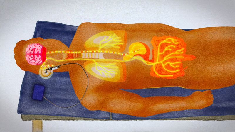 Mit elektrischen Reizen kann man das Nervensystem gezielt stimulieren.