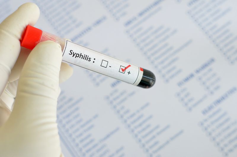 Syphilis wird insbesondere durch direkten körperlichen Kontakt übertragen.