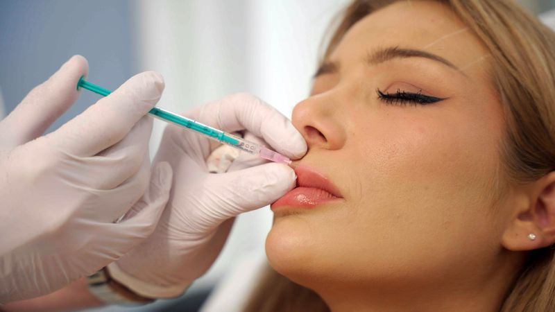 Für die perfekten Lippen nimmt Reality-TV Star Melody schmerzhafte Spritzen in Kauf.