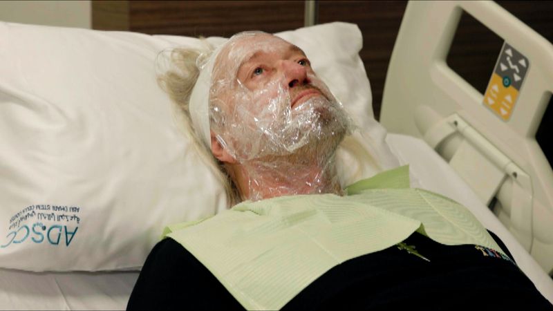 Robert Geiss unterzieht sich einem sogenannten Vampirlifting.