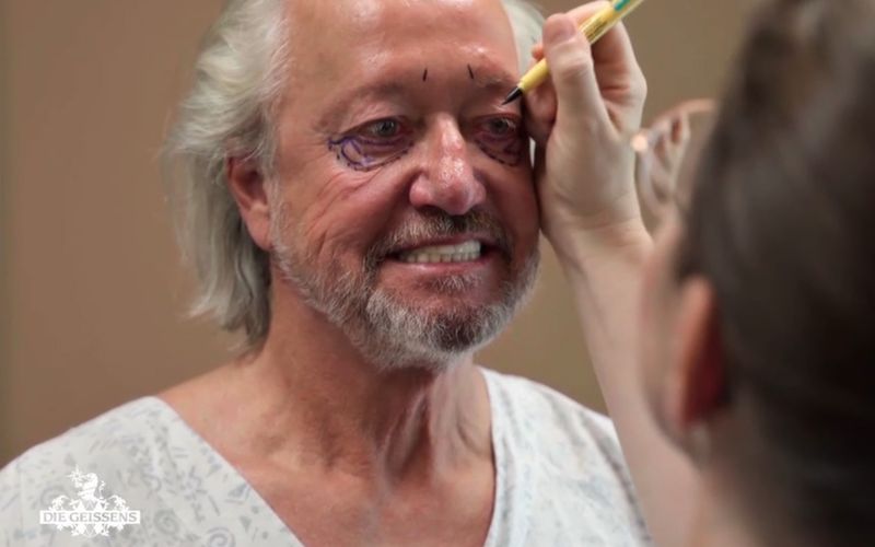 Robert Geiss legt sich mit 62 Jahren erstmals unters Messer.