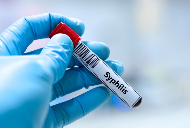 Unbehandelte Geschlechtskrankheiten wie Syphilis können die Gesundheit stark beeinträchtigen.